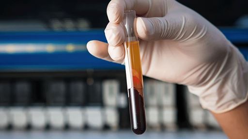 Cell Free DNA in Pathology