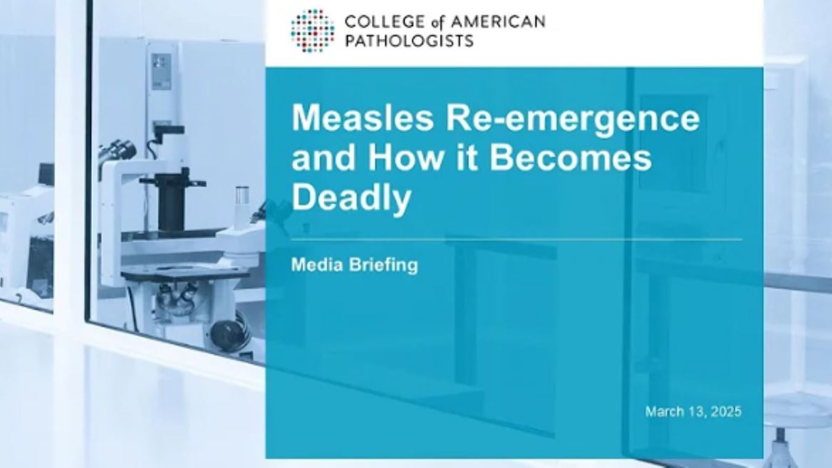 Measles Re emergence and How it Becomes Deadly