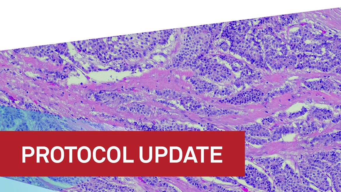 CAP statement on Salivary Gland and HPV Associated Oropharyngeal Carcinomas